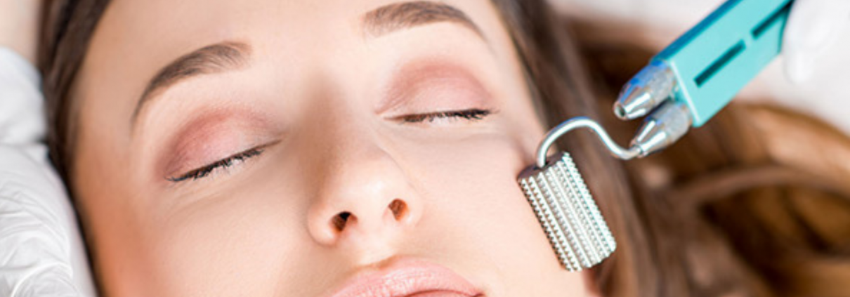 i Benefici del Microneedling
