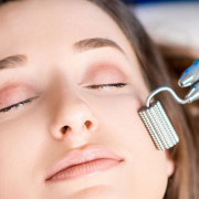 i Benefici del Microneedling